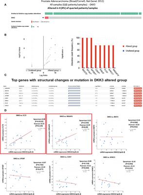 DKK3’s protective role in prostate cancer is partly due to the modulation of immune-related pathways